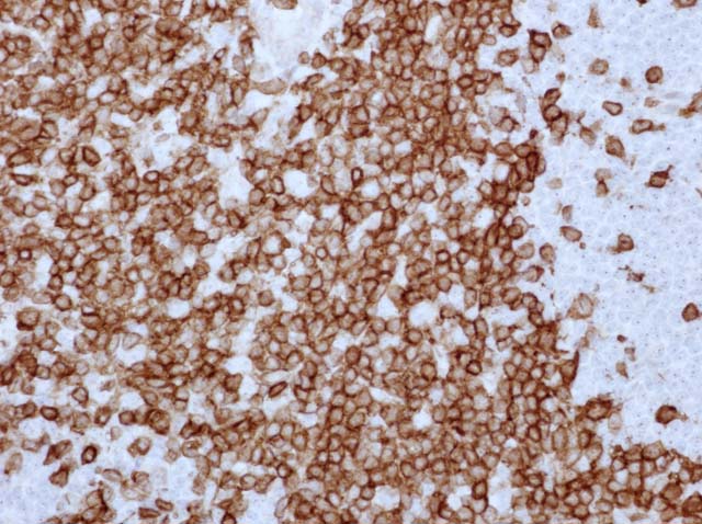 60-0011 61-0011 Rb x CD3 stained Tonsil 