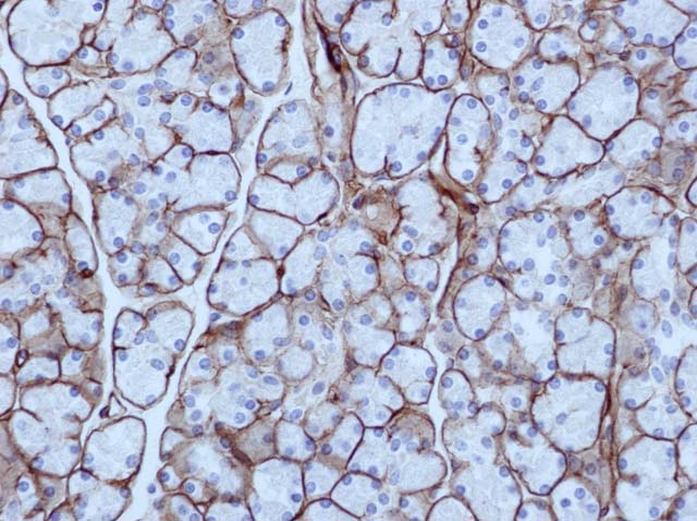 60-0113 61-0113 Rb x Laminin stained pancreas 