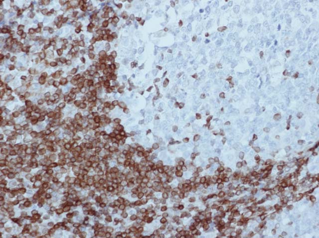 60-0005 61-0005 Ms x Bcl2 stained tonsil 