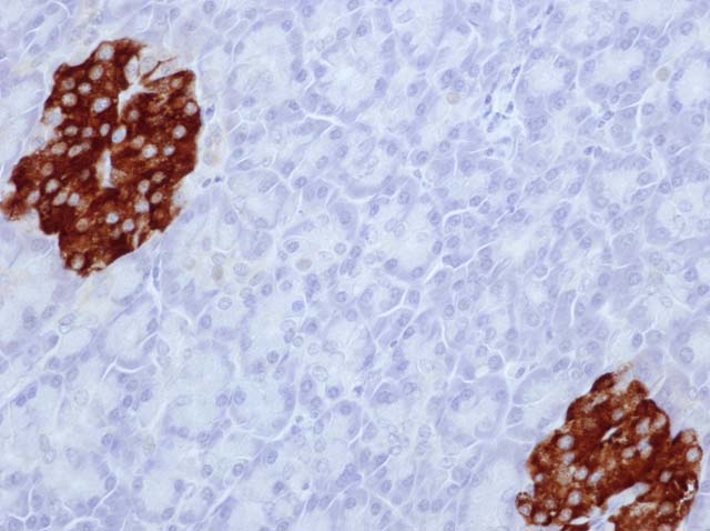 60-0039 61-0039 Ms x Insulin stained pancreas 