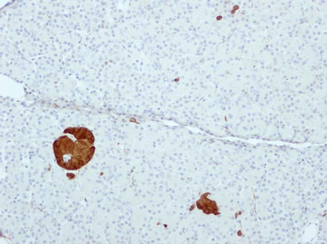60-0131 61-0131 Ms x NSE stained pancreas 