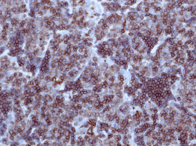 60-0143 61-0143 Ms x CD1a stained Thymus 