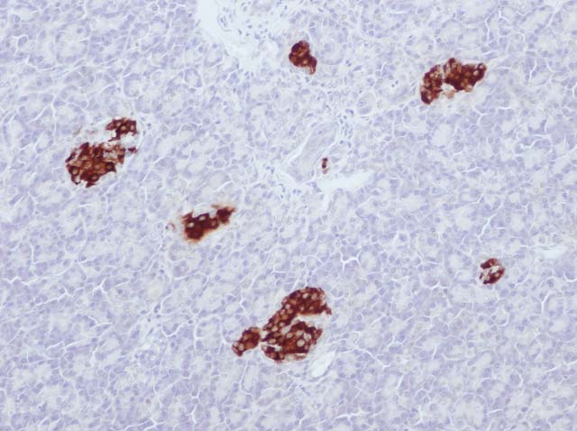 60-0039 61-0039 Ms x Insulin stained pancreas 
