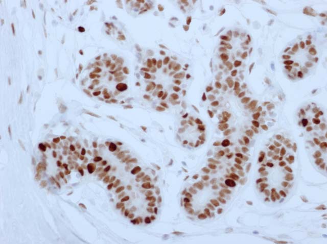 60-0054 61-0054 Ms x PCNA stained breast 