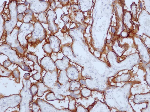 60-0139 61-0139 Ms x PLAP stained placenta 