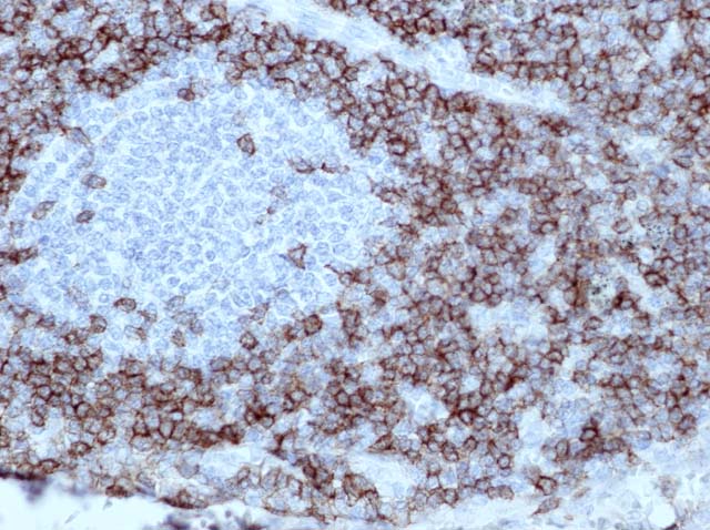 60-0137 61-0137 Ms x CD5 stained normal lymph node 
