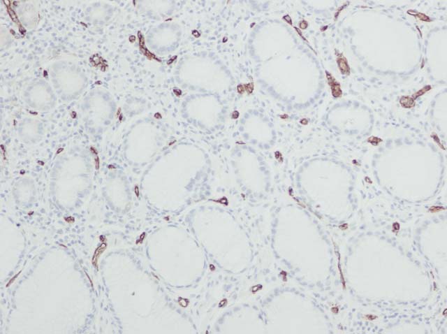 60-0012 61-0012 Ms x CD34 Stained Stomach 